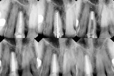 June-case-of-the-month-x-ra