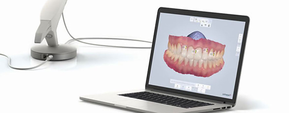 CAD/CAM tehnologija