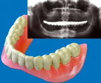 material for radiology and computer tomography