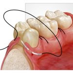 zubna kirurgija